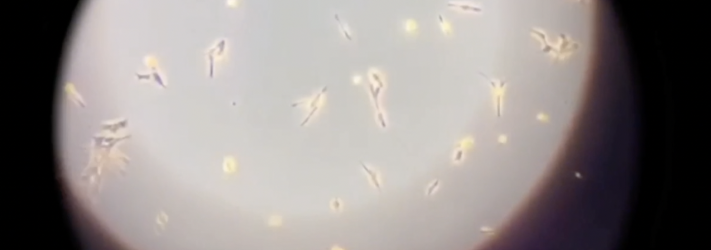 Pasantías con el microscopio